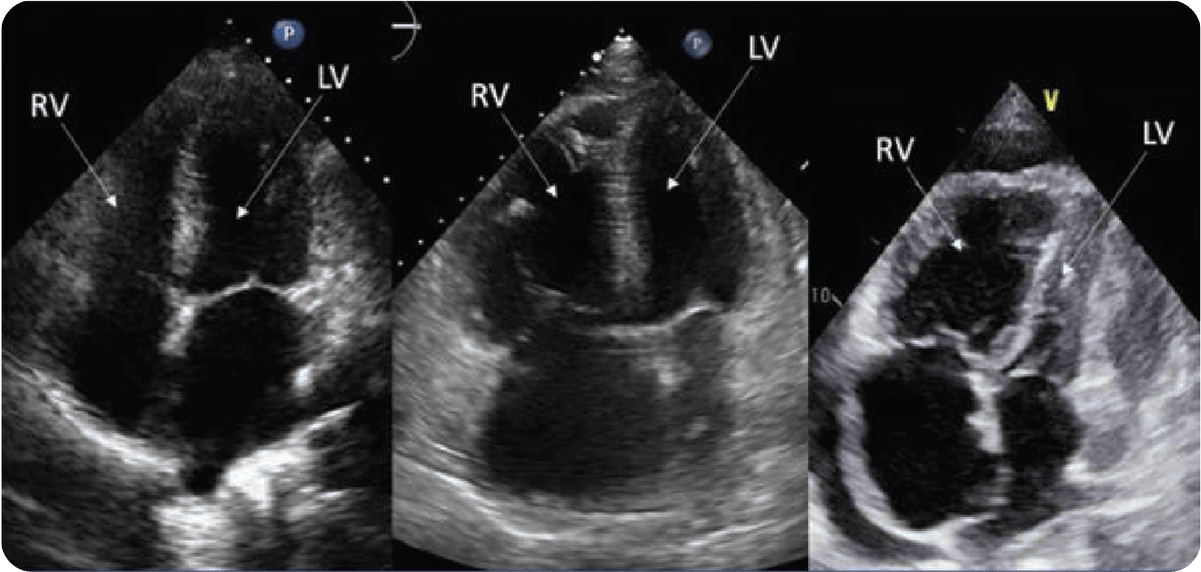 Echo Image